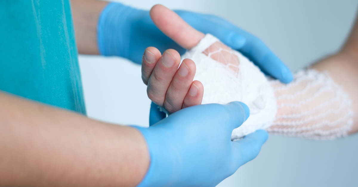 doctor bandaging one hand
